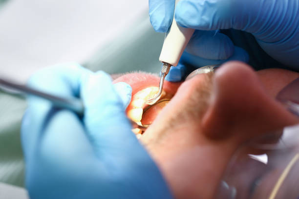 Best Emergency Gum Treatment in Culver City, CA